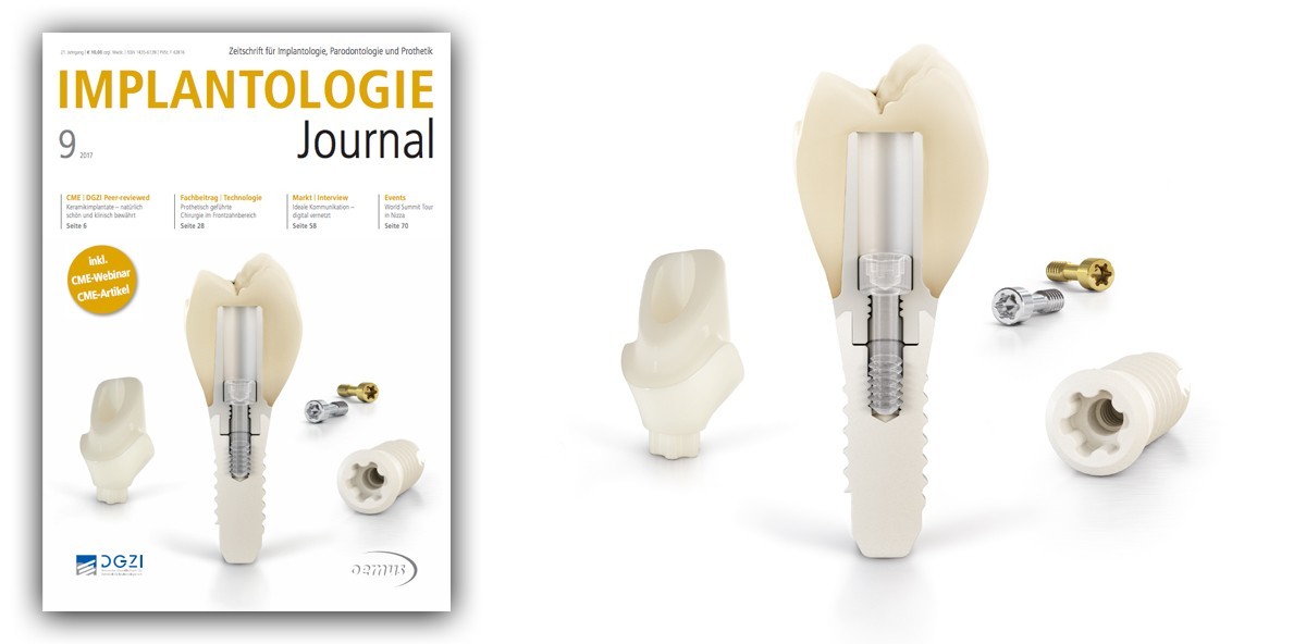 Aktuelles Implantologie Journal jetzt online lesen