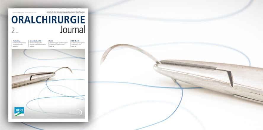 Das aktuelle Oralchirurgie Journal ab sofort online lesen