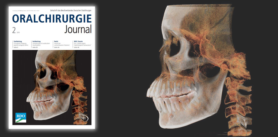 Aktuelles Oralchirurgie Journal ab sofort verfügbar