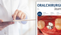 Vielfältige Themen im aktuellen Oralchirurgie Journal