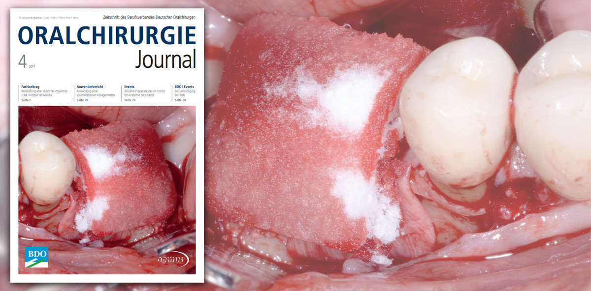 Themenvielfalt im aktuellen Oralchirurgie Journal