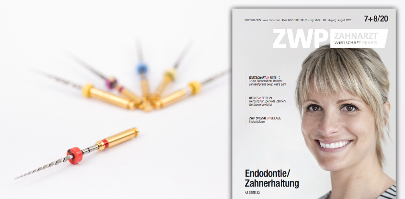 Fokus auf Endo: August-Ausgabe der ZWP jetzt online
