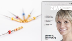 Fokus auf Endo: August-Ausgabe der ZWP jetzt online