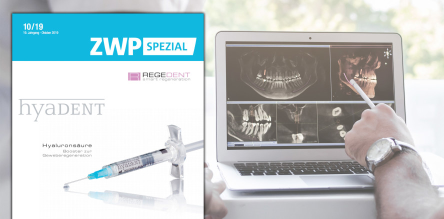 ZWP spezial nimmt Knochen- und Geweberegeneration ins Visier