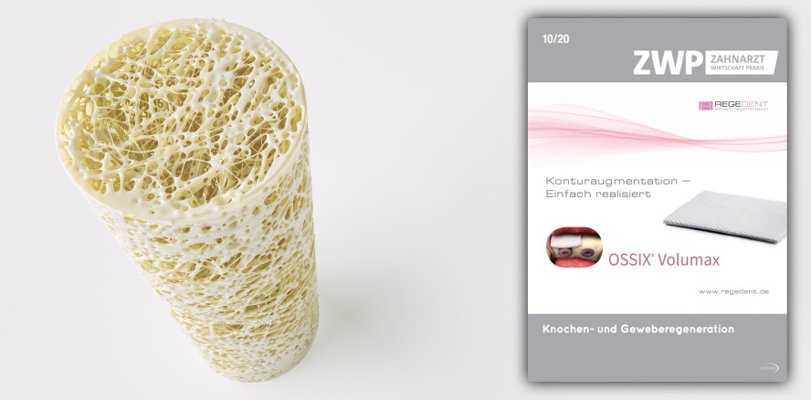 Aktuelles ZWP spezial zur Knochen- und Geweberegeneration