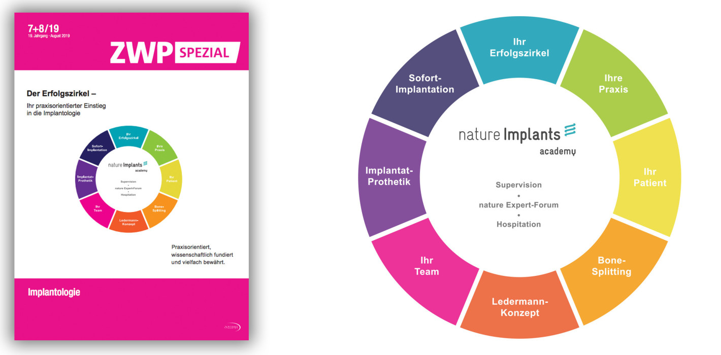 ZWP spezial mit Fokus auf „Implantologie“ jetzt als ePaper lesen
