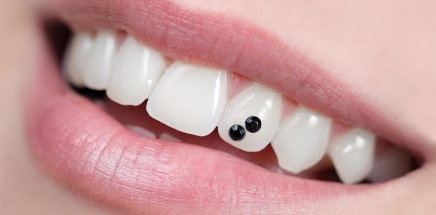 Back to the 90s: Tooth Gems sind wieder da!