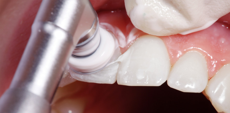 61 Prozent der Deutschen gehen jährlich zur PZR