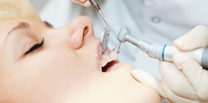 Kassenumfrage 2017 zur Professionellen Zahnreinigung