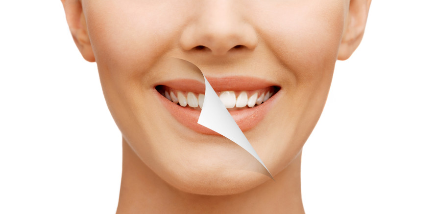 Urteil: Werbeversprechen „perfekte Zähne“ unzulässig