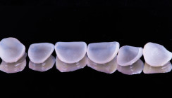 Viraler Hit: Zahnarzt testet selbstklebende Veneers von Amazon