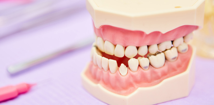 52.882 Euro für versäumte KFO-Behandlung