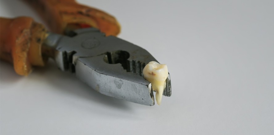 Frau zieht ihrem Sohn Zähne mit Zange auf Walmart-Toilette