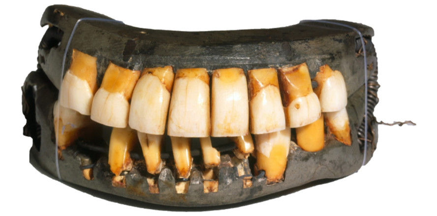 Erster US-Präsident hatte bereits künstliche Zähne