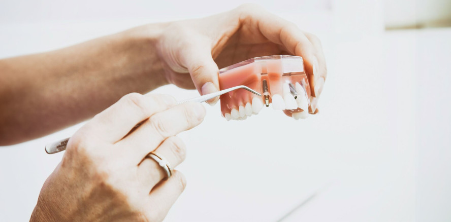 Moderne Zahnmedizin: Ein neues Lächeln durch Zahnimplantate