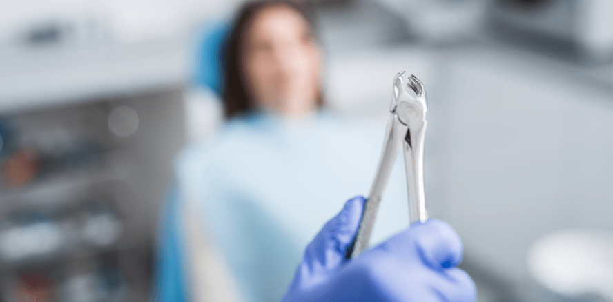 Entfernung von Weisheitszähnen bei Jugendlichen: Ist früher besser?