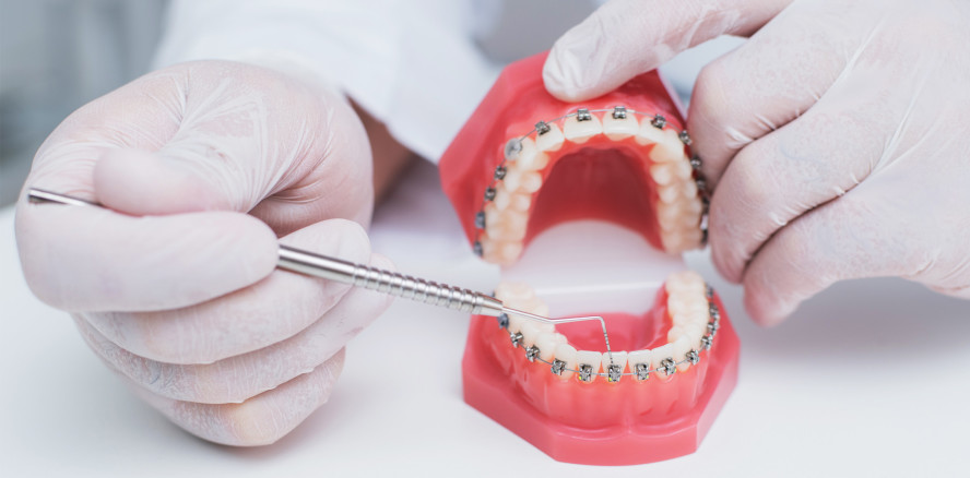 Die Fachzahnarztausbildung zum Kieferorthopäden