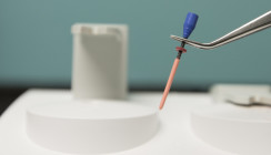 Einsatz von Nanodiamanten bei der Wurzelkanalbehandlung