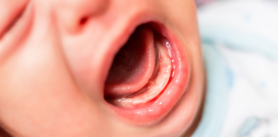 Stiftung Kindergesundheit: Zähnekriegen macht nicht krank!