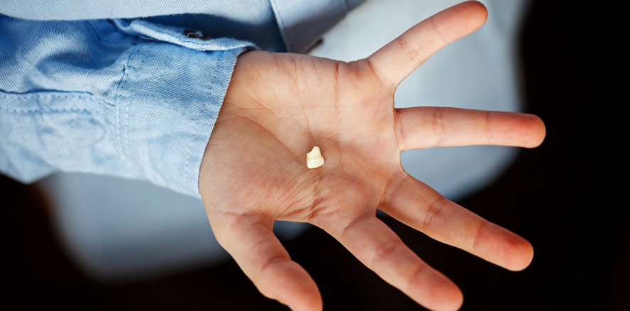 Der 90-Dollar-Zahnersatz: Zahnfee verteilt jährlich ein Vermögen