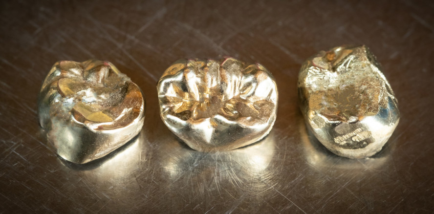 Zahngold im Krematorium – Prozess um Steuerhinterziehung