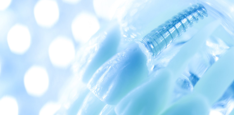 Geprüfte Zahnimplantate haben wissenschaftlich belegte Erfolgsraten