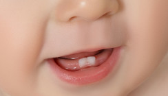 Die richtige Zahnpflege beim ersten Babyzahn