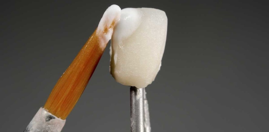 Urteil: Selbstständige Zahntechniker müssen den Meister haben