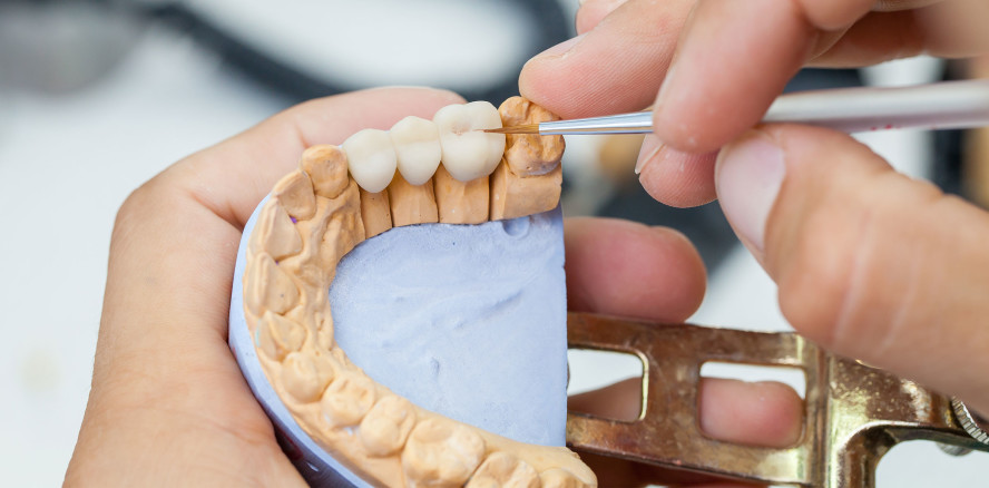 Zahntechnik plus 2024: Branchentreff geht in zweite Runde