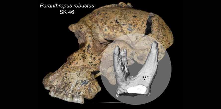Anthropologen rätseln: Die Zahnwurzeln unserer Vorfahren