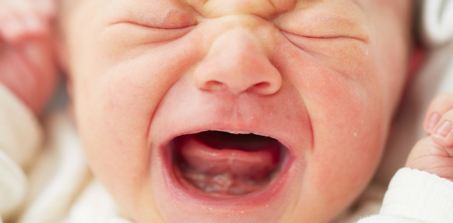 Das zu kurze Zungenband in der Kinderzahnheilkunde