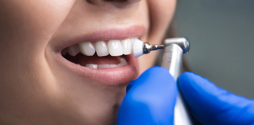 Zahnreinigung: Diese gesetzlichen Krankenkassen zahlen einen Zuschuss