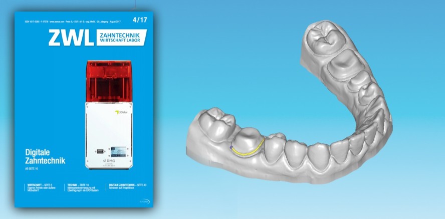 Aktuelle Ausgabe der ZWL mit Schwerpunkt Digitale Zahntechnik