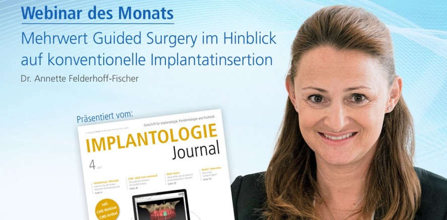 Heutiges Webinar: Mehrwert von Guided Surgery