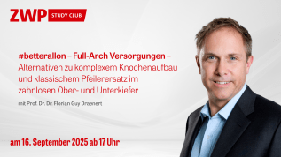 #betterallon – Full-Arch Versorgungen