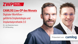 CAMLOG Live-OP zum digitalen Workflow