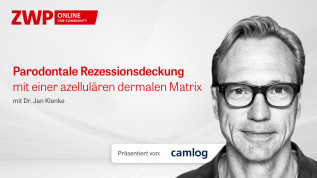 Parodontale Rezessionsdeckung mit einer azellulären dermalen Matrix