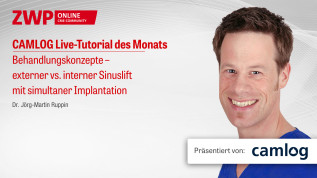 Behandlungskonzepte – externer vs. interner Sinuslift mit simultaner Implantation