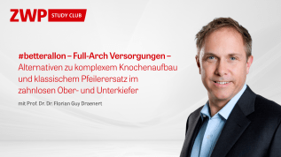 #betterallon – Full-Arch Versorgungen