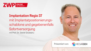 Implantation Regio 37 mit Implantatpositionierungsschablone und ggf. Sofortversorgung