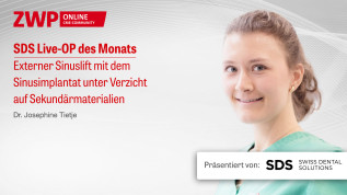 SDS Live-OP zum externen Sinuslift
