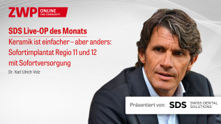 SDS Live-OP des Monats: Keramik ist einfacher – aber anders