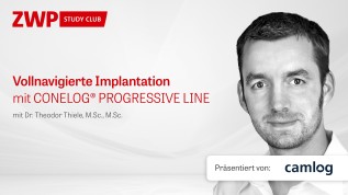 Vollnavigierte Implantation mit CONELOG® PROGRESSIVE-LINE