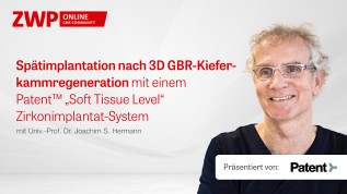 Spätimplantation nach 3D GBR-Kieferkammregeneration