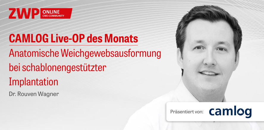 1 CME-Punkt: CAMLOG Live-OP im Archiv abrufbar