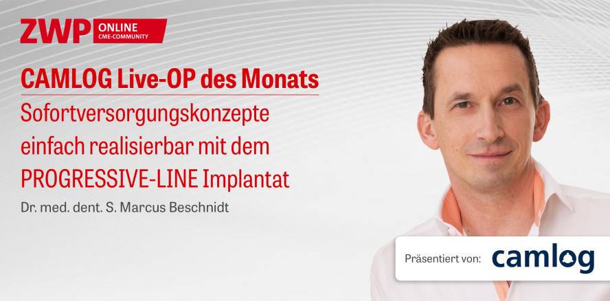 1 CME-Punkt: CAMLOG Live-OP mit Dr. Beschnidt jetzt im Archiv