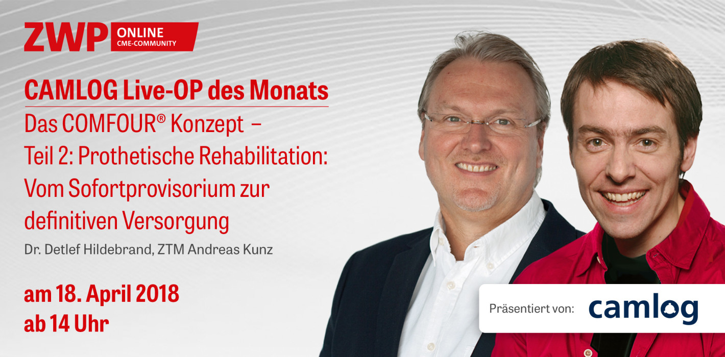 Heute ab 14 Uhr: CAMLOG Live-OP „Das COMFOUR® Konzept – Teil 2“