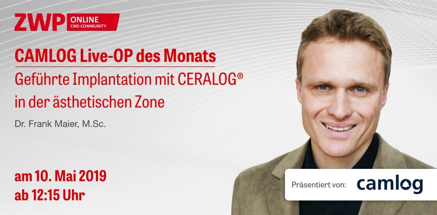 Heute Live-OP ab 12.15 Uhr: Geführte Implantation mit CERALOG®