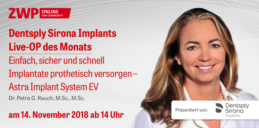 Heute ab 14 Uhr einschalten: Dentsply Sirona Implants Live-OP