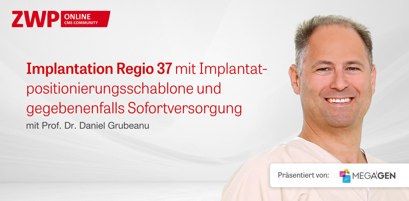 OP zum Thema „Implantation Regio 37 mit Positionierungsschablone”